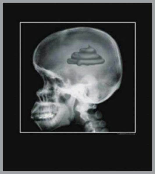 poop-brain1.jpg